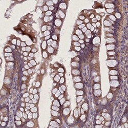 CGI-128 Antibody, Novus Biologicals 0.1mL; Unlabeled:Antibodies, Polyclonal